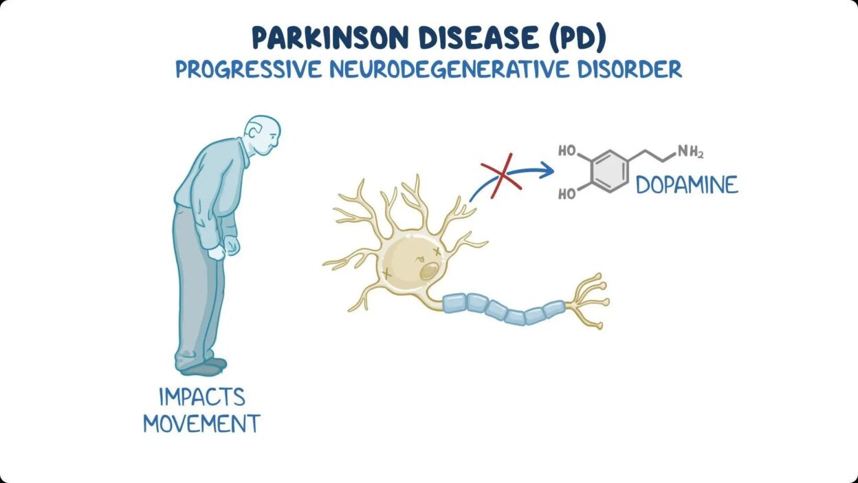 Parkinson’s disease, Parkinson’s disease symptoms, I cured my Parkinson’s disease, Parkinson’s disease treatment, Parkinson’s disease cause, 40 symptoms of Parkinson’s disease, Parkinson’s disease dopamine, Parkinson’s disease early symptoms,