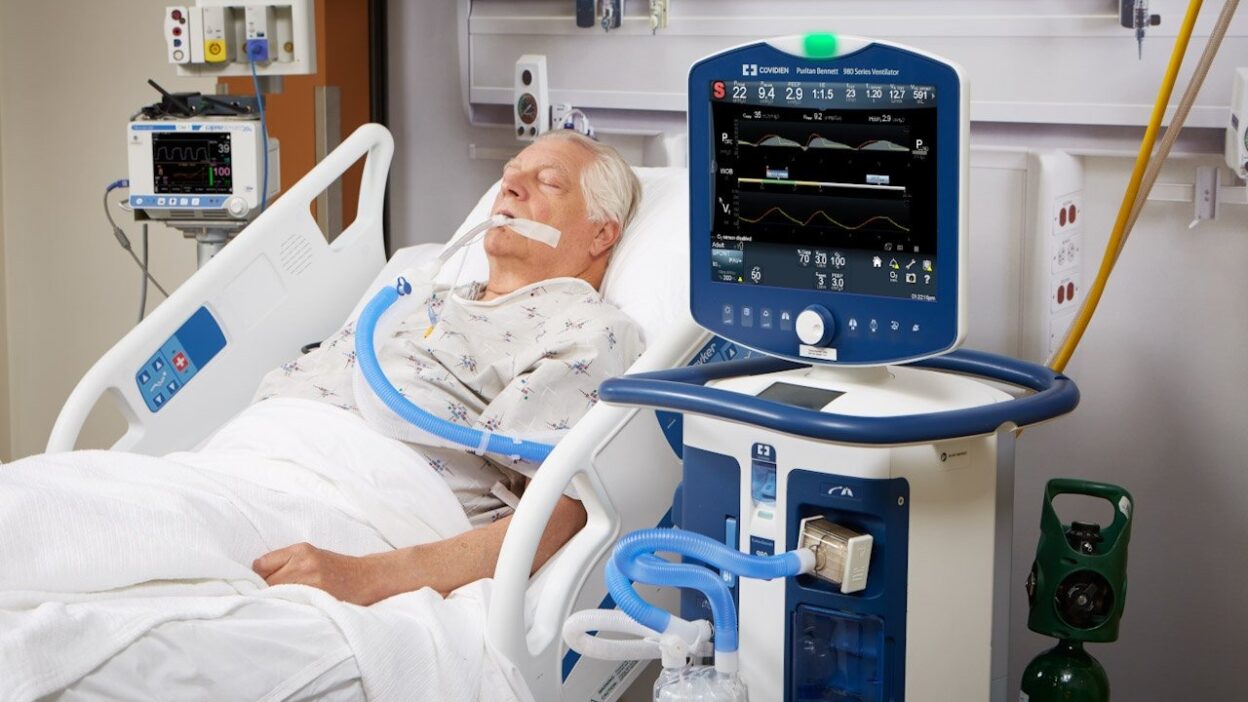 ventilation, Mechanical ventilation, ventilator machine, intubation procedure, ICU breathing support, PEEP settings, How long can you be on a ventilator?, ventilator weaning process steps, CPAP vs BiPAP for home use, risks of mechanical ventilation, ventilator settings for ARDS, cost of ventilator per day in ICU, tracheostomy vs intubation, ventilator-associated pneumonia prevention
