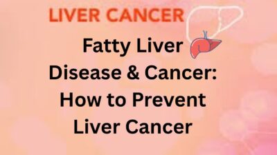 liver,liver cancer prevention, hepatitis B vaccine, fatty liver disease, alcohol and liver cancer, Liver cancer prevention, Hepatitis B vaccine and liver cancer, Fatty liver disease and cancer risk, Alcohol and liver cancer link, How to avoid liver cancer, Early signs of liver cancer, Best diet for liver health, Is liver cancer preventable?, Liver cancer causes and risk factor, MASLD and liver cancer connection,