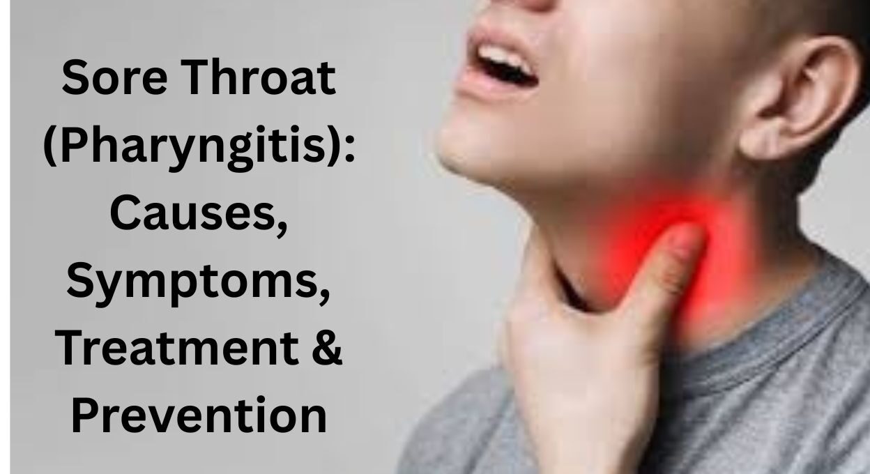 sore throat, pharyngitis, strep throat, how to treat a sore throat, sore throat , sore throat medication, sore throat treatment, what kills a sore throat fast, sore throat medicine, what kills a sore throat fast overnight, sore throat meaning, sore throat symptoms, sore throat meaning in hindi,