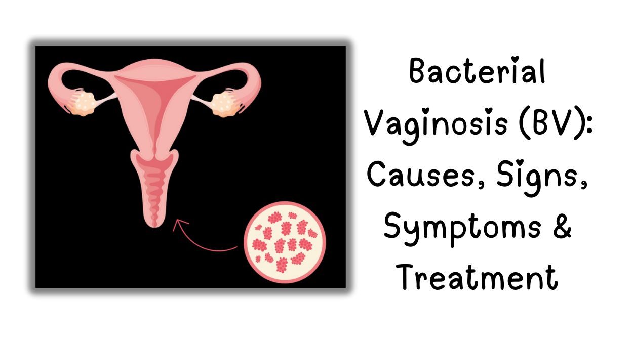 Bacterial vaginosis, BV symptoms, BV treatment, BV vs yeast infection, Fishy odor discharge, How to cure BV fast Recurrent BV,, BV during pregnancy, Is BV contagious?, Best BV antibiotics Natural BV remedies,, Can men get BV?, BV prevention tips, Does BV go away on its own?,BV and STDs,