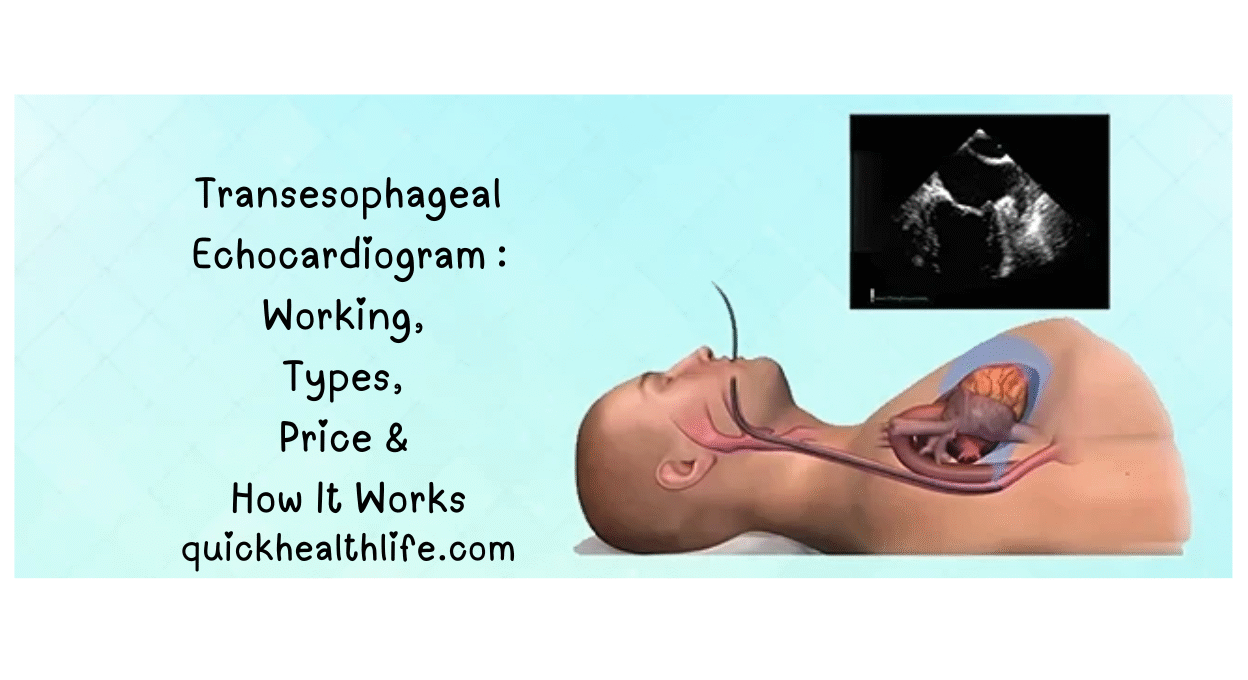transesophageal echocardiogram, TEE test, why is a transesophageal echocardiogram performed, TEE heart test side effects, transesophageal echocardiography views, are you awake during a transesophageal echocardiogram, what to expect with a transesophageal echocardiogram, benefits of TEE test, transesophageal echocardiography indications and contraindications, TEE vs echo, what is a TEE test for transesophageal echocardiogram, what is a TEE used for, how serious is a TEE procedure, TEE procedure cost, TEE test working, types of TEE, echocardiogram vs TEE, cardiac imaging test, ultrasound heart test, TEE for heart valve problems