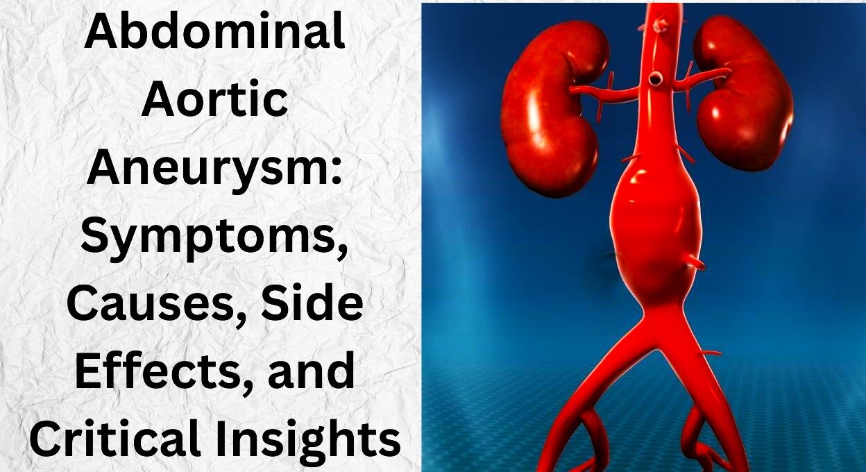 Abdominal Aortic Aneurysm, abdominal aortic aneurysm , abdominal aortic aneurysm cause, abdominal aortic aneurysm treatment, abdominal aortic aneurysm side effects, abdominal aortic aneurysm symptoms, aortic aneurysm in females symptoms, abdominal aortic aneurysm treatment, leaking abdominal aortic aneurysm symptoms, abdominal aortic aneurysm causes, abdominal aortic aneurysm icd-10, how long can you live with a ruptured abdominal aortic aneurysm, abdominal aortic aneurysm radiology,