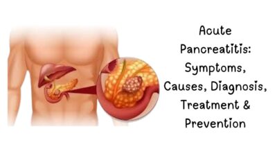 Acute Pancreatitis