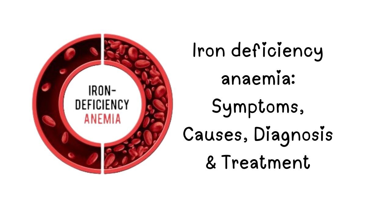 Iron deficiency anemia, Iron-deficiency anemia, Low iron symptoms, Anemia treatment, Ferritin levels, Best iron-rich foods, Iron supplements, Causes of anemia, How to increase hemoglobin, Anemia in women, Signs of iron deficiency,
