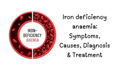 Iron deficiency anemia, Iron-deficiency anemia, Low iron symptoms, Anemia treatment, Ferritin levels, Best iron-rich foods, Iron supplements, Causes of anemia, How to increase hemoglobin, Anemia in women, Signs of iron deficiency,
