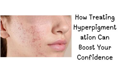 Hyperpigmentation