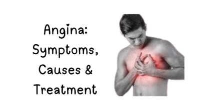 Angina