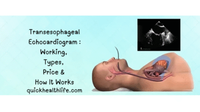 transesophageal echocardiogram, TEE test, why is a transesophageal echocardiogram performed, TEE heart test side effects, transesophageal echocardiography views, are you awake during a transesophageal echocardiogram, what to expect with a transesophageal echocardiogram, benefits of TEE test, transesophageal echocardiography indications and contraindications, TEE vs echo, what is a TEE test for transesophageal echocardiogram, what is a TEE used for, how serious is a TEE procedure, TEE procedure cost, TEE test working, types of TEE, echocardiogram vs TEE, cardiac imaging test, ultrasound heart test, TEE for heart valve problems