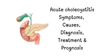 acute cholecystitis , acute cholecystitis treatment, acute cholecystitis symptoms, acute cholecystitis racgp, acute cholecystitis causes, acute cholecystitis diagnosis, chronic cholecystitis, acute cholecystitis icd-10, acute cholecystitis - statpearls