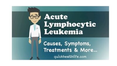 Acute lymphoblastic leukaemia, acute lymphoblastic leukemia , acute lymphoblastic leukemia symptoms, acute lymphoblastic leukemia in adults, acute lymphoblastic leukemia in children, acute lymphoblastic leukemia treatment, acute lymphoblastic leukemia child survival rate,, acute lymphoblastic leukemia vs acute lymphocytic leukemia, acute lymphoblastic leukemia diagnosis,