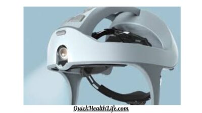 ortho helmet,baby helmet for flat head cost, plagiocephaly ,helmet cost in india ,helmet therapy ,cranial helmet ,helmet for baby ,head shape ,cranial orthosis (helmet cost) ,baby head shape ,helmet online cranial remolding helmet ,cranial orthosis helmet cost,