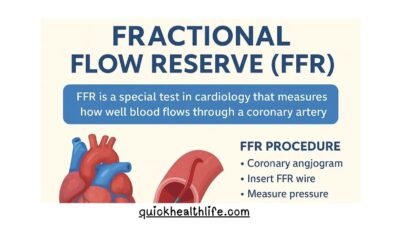 fractional flow reserve, ffr meaning, ffr cardiology, ffr cardiology normal range, ffr cardiology procedure, ffr in finance, ffr vs angiography, ffr formula, fractional flow reserve procedure, fractional flow reserve ppt, fractional flow reserve formula, fractional flow reserve ct, ffr cardiology normal range, coronary flow reserve, ffr vs angiography,, fractional flow reserve test,