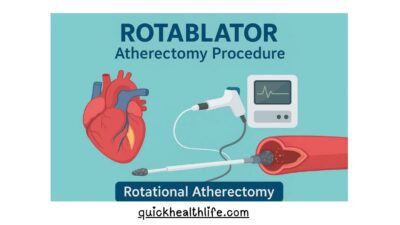 Rotablator