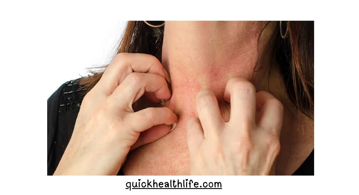 Anaphylaxis