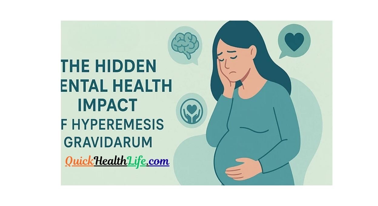 Hyperemesis Gravidarum