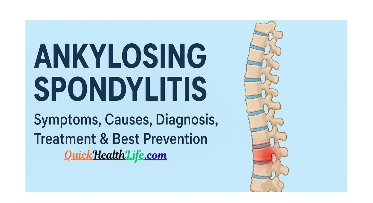 ankylosing spondylitis, ankylosing spondylitis medication, ankylosing spondylitis treatment, ankylosing spondylitis symptoms, ankylosing spondylitis diagnosis, ankylosing spondylitis symptoms females, how i cured my ankylosing spondylitis,, ankylosing spondylitis test, ankylosing spondylitis icd-10, Can ankylosing spondylitis be cured?, What is Stage 1 ankylosing spondylitis?, What is the life expectancy of someone with ankylosing spondylitis?, Is HLA-B27 positive life threatening?