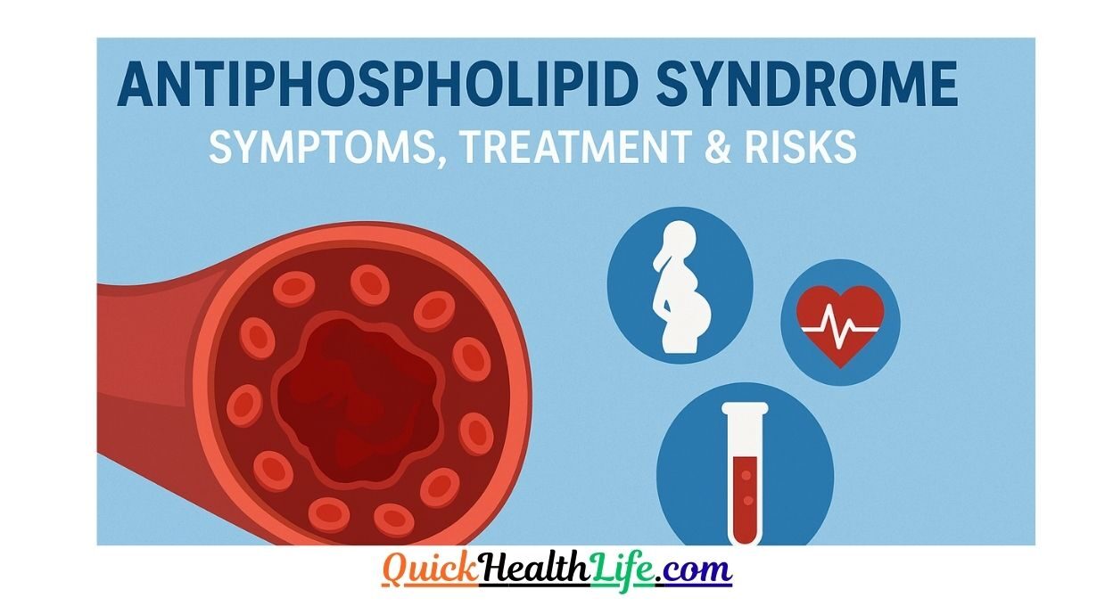 antiphospholipid syndrome, antiphospholipid syndrome in pregnancy, antiphospholipid syndrome treatment, antiphospholipid syndrome in pregnancy criteria, antiphospholipid syndrome symptoms, antiphospholipid syndrome antibodies, antiphospholipid syndrome rash pictures, antiphospholipid syndrome test, can antiphospholipid syndrome cause weight gain, How do you diagnose antiphospholipid syndrome?,