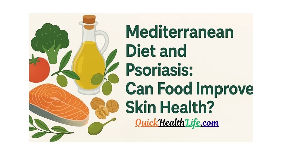 Psoriasis, mediterranean diet psoriasis, best diet for psoriasis patients, diet for psoriasis relief, mediterranean diet for skin health, anti-inflammatory diet psoriasis, foods that help psoriasis naturally, psoriasis and mediterranean lifestyle, diet plan for psoriasis 2025, natural remedies for psoriasis diet, psoriasis treatment with diet, mediterranean diet and autoimmune diseases, psoriasis diet research studies, psoriasis foods to eat and avoid,