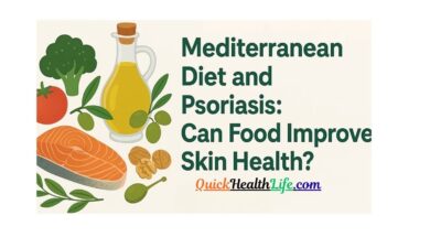 Psoriasis, mediterranean diet psoriasis, best diet for psoriasis patients, diet for psoriasis relief, mediterranean diet for skin health, anti-inflammatory diet psoriasis, foods that help psoriasis naturally, psoriasis and mediterranean lifestyle, diet plan for psoriasis 2025, natural remedies for psoriasis diet, psoriasis treatment with diet, mediterranean diet and autoimmune diseases, psoriasis diet research studies, psoriasis foods to eat and avoid,
