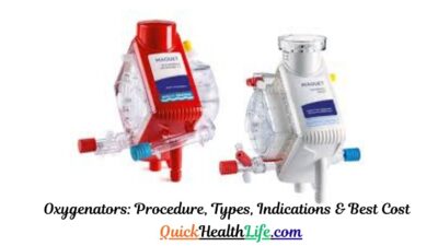oxygenators , oxygenators ppt , oxygenators for ponds, oxygenators for sale, , oxygenators plants for ponds, oxygenators for small ponds, oxygenators for home use, oxygenator market, oxygenators plants, oxygenators for ponds with fish, types of oxygenators, oxygenator price, bubble oxygenator types of oxygenators pdf, types of oxygenators used in heart-lung machine, types of oxygenators ppt, membrane oxygenator, oxygenator in cpb, What are oxygenators used for?, What are the different types of oxygenators?, What are oxygenators in CPB?,