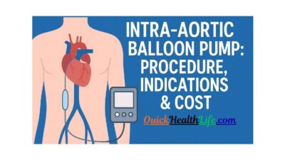 Intra Aortic Balloon Pump