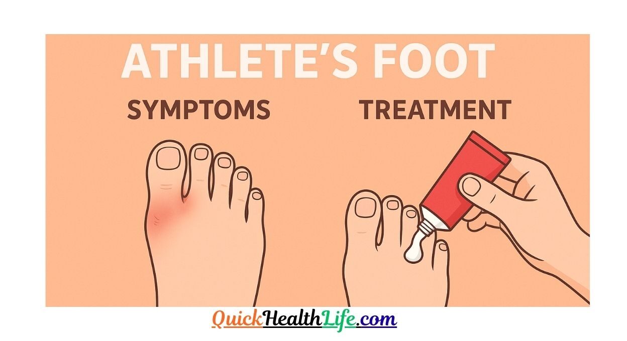 athletes foot, athletes foot cream, what kills athlete's foot instantly, athlete's foot treatment, is athlete's foot dangerous, how to cure athlete's foot in one day, types of athlete's foot pictures, is athlete's foot contagious, athlete's foot pictures blisters, What is the main cause of athlete's foot?, How do I cure my athlete's foot?, Is athlete's foot ringworm?, Does athlete's foot go away by itself?,