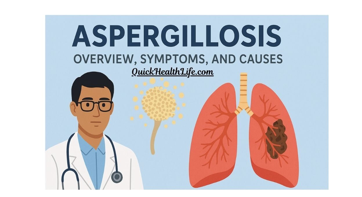 aspergillosis , aspergillosis treatment, aspergillosis symptoms, aspergillosis causes, aspergillosis diagnosis, pulmonary aspergillosis, invasive aspergillosis, can aspergillosis be cured, what is aspergillosis caused by, how do you treat aspergillus, is aspergillus a TB, aspergillosis ppt