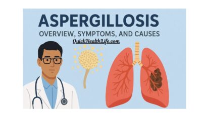 aspergillosis , aspergillosis treatment, aspergillosis symptoms, aspergillosis causes, aspergillosis diagnosis, pulmonary aspergillosis, invasive aspergillosis, can aspergillosis be cured, what is aspergillosis caused by, how do you treat aspergillus, is aspergillus a TB, aspergillosis ppt