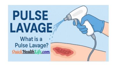Pulse Lavage