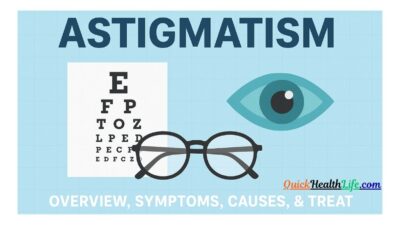 Astigmatism , astigmatism glasses, astigmatism test, astigmatism treatment, what causes astigmatism to worsen, astigmatism symptoms, causes of astigmatism, astigmatism vision, astigmatism severity scale, What causes astigmatism?, Can astigmatism be corrected?, What to avoid when having astigmatism?, Can you heal astigmatism naturally?