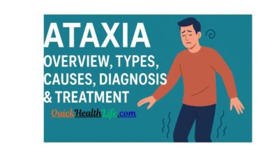 Ataxia , ataxia causes, death from ataxia, ataxia treatment, cerebellar ataxia, what are the 3 types of ataxia, ataxia icd-10, ataxia vs apraxia, sensory ataxia, What is ataxia and what causes it?, What is the best treatment for ataxia?,