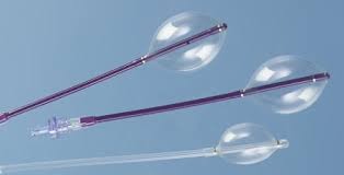 balloon catheter, balloon catheter induction balloon catheter uses balloon catheter price balloon catheter types balloon catheter uterus balloon catheter pregnancy balloon catheter angioplasty balloon catheter size What is a balloon catheter used for? How painful is a balloon catheter? What is the balloon of a catheter?