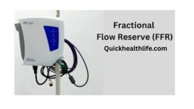 FFR machine, ffr cardiology normal range, ffr cardiology procedure, ffr test price, ffr meaning, disadvantages of ffr, ffr vs angiography, ffr formula, ivus machine cost in india, What is the FFR machine in cardiology?, What is the cost of FFR in cardiology?, What is FFR and IVUs?, What drug is used for FFR?,