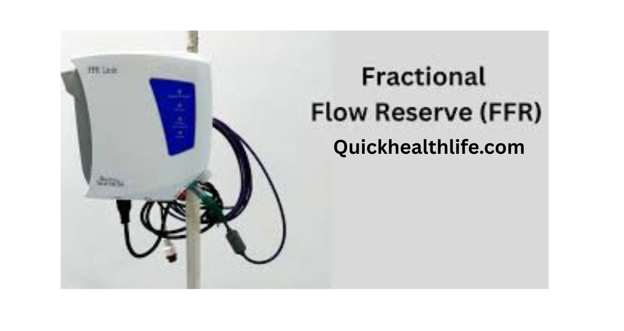 FFR Machine: Working, Types, Price & How It Works - QuickHealthLife