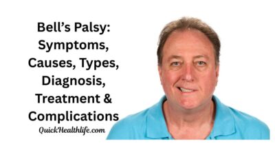 bell’s palsy symptoms, bell’s palsy causes, bell’s palsy treatment, is bell’s palsy dangerous, bell’s palsy vs stroke, bell’s palsy recovery after 2 years, what triggers bell’s palsy, what to avoid during bell’s palsy, fastest way to cure bell’s palsy, is bell’s palsy permanent, facial nerve pain, bell’s palsy diagnosis, bell’s palsy complications,