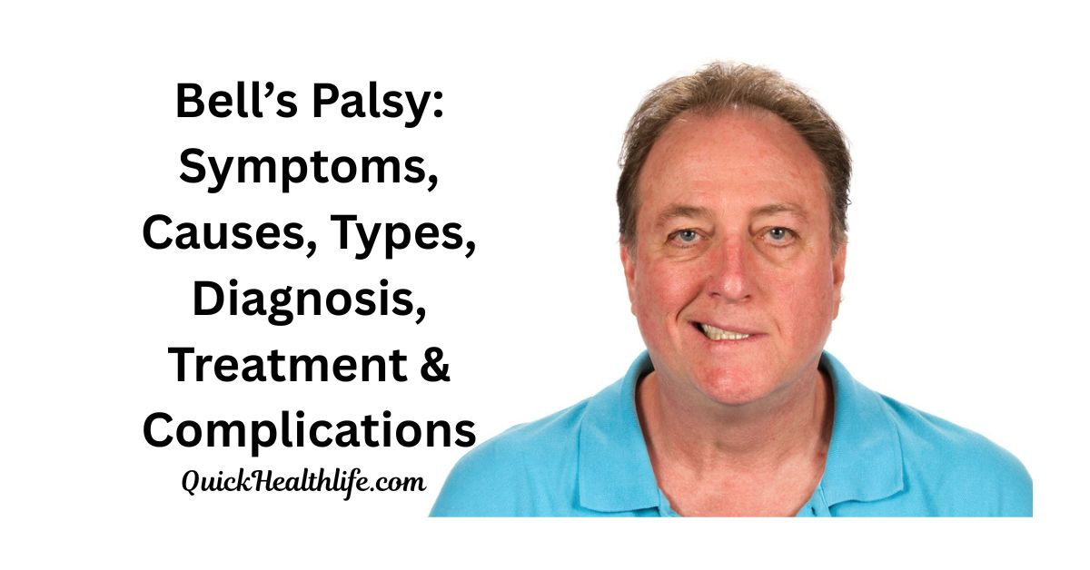 bell’s palsy symptoms, bell’s palsy causes, bell’s palsy treatment, is bell’s palsy dangerous, bell’s palsy vs stroke, bell’s palsy recovery after 2 years, what triggers bell’s palsy, what to avoid during bell’s palsy, fastest way to cure bell’s palsy, is bell’s palsy permanent, facial nerve pain, bell’s palsy diagnosis, bell’s palsy complications,